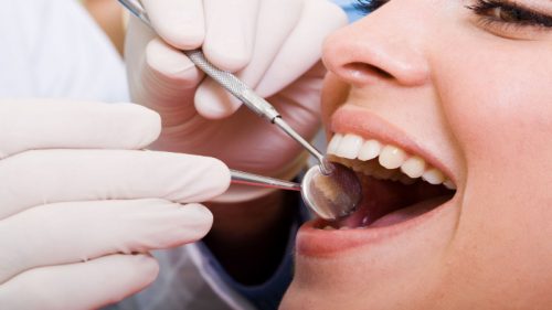 Where To Find Bleeding Gums Treatment