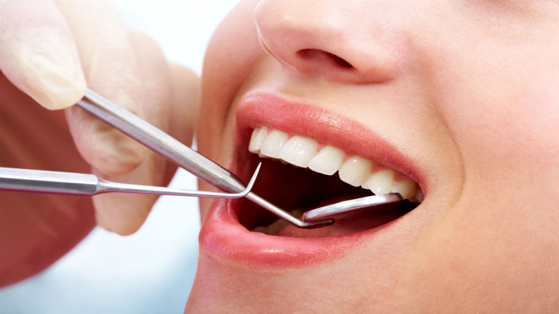 Sleep Dentistry In Castle Hill: Advantages